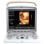 Chison Q5 ultrasound machine