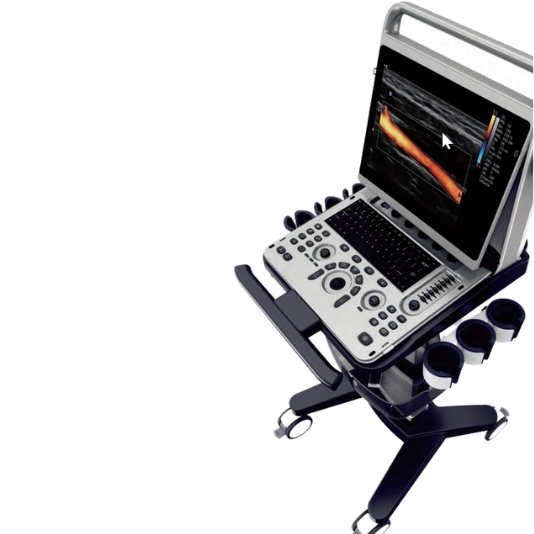 Chison-EBit 50 ultrasound on a stand