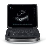 Sonosite-Edge-II ultrasound machine
