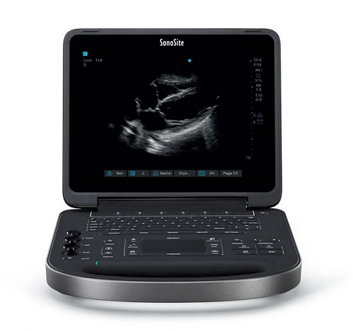 Sonosite-Edge-II ultrasound machine